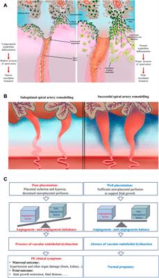 Regulatory mechanism and research progress of ferroptosis in obstetrical and gynecological diseases